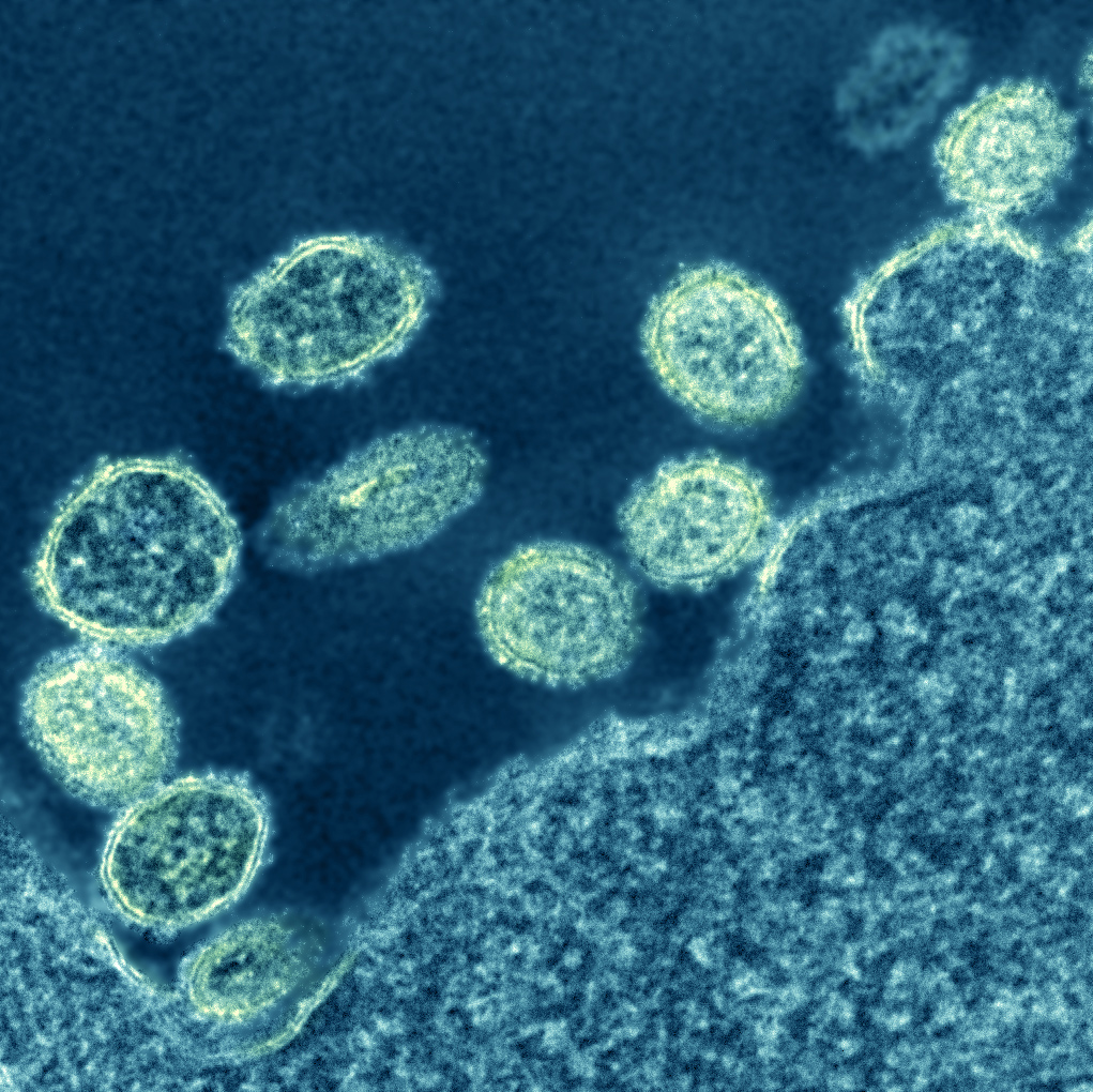 H1N1 virus under microscope
