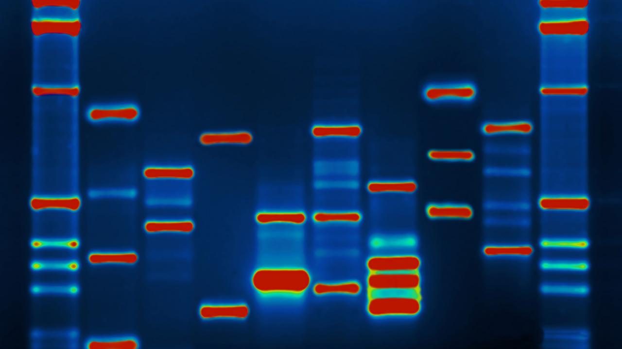 DNA Profile. Micah Baldwin