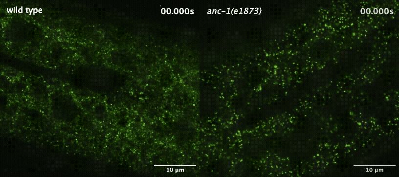 Bright green GEMs (dots) in worm tissue