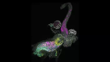 Confocal image of a Drosophila uterus with fluorescent markers in magenta, green, yellow, and cyan, highlighting cellular structures and nuclei.