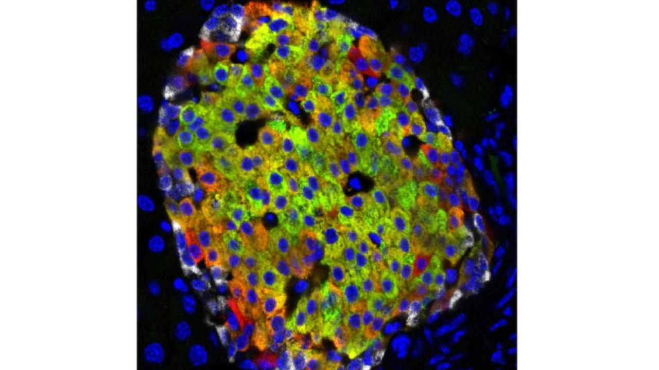 Pancreatic islets make insulin in response to blood glucose. In this image, cells are stained red for insulin and green for a marker of mature beta cells, so the mature cells are green/orange. Red cells at the edges are a newly discovered type of immature insulin-producing cell. Mark Huising/UC Davis Pancreatic islets make insulin in response to blood glucose. In this image, cells are stained red for insulin and green for a marker of mature beta cells, so the mature cells are green/orange. Red cells at the edges are a newly discovered type of immature insulin-producing cell. Mark Huising/UC Davis