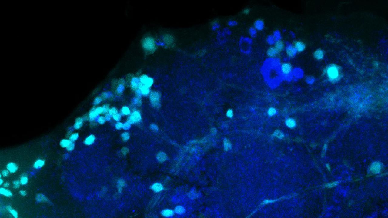 Fluorescent microscope view of fruit fly brain showing light and dark blue labeled neurons.