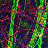 Micro imagery of tissue