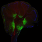 Cerebellum
