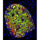 Pancreatic islets make insulin in response to blood glucose. In this image, cells are stained red for insulin and green for a marker of mature beta cells, so the mature cells are green/orange. Red cells at the edges are a newly discovered type of immature insulin-producing cell. Mark Huising/UC Davis