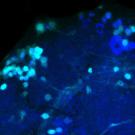 Fluorescent microscope view of fruit fly brain showing light and dark blue labeled neurons.
