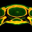 UC Davis researchers are investigating whether a gene called Chd8 mediates the symptoms of autism, in part, by disrupting the function of the cerebellum. Shown here is the cross section of a mouse cerebellum, with orange fluorescence revealing nerve cells that express Chd8. (Se Jung Jung, Fioravante lab / UC Davis)