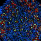 Research in the Department of Microbiology and Molecular Genetics suggests that a crucial event happens around the time of birth: the nascent egg cells enter a holding pattern, with their DNA precisely packaged and primed for fertilization later in life. Shown here is ovary tissue from a newborn mouse, with immature egg cells fluorescing green and red. (Yasuhisa Munakata/UC Davis)