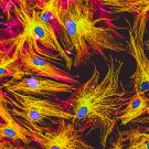 In festive holiday colors, human skin cells in culture. Nuclei are in blue, actin filaments are in pink, tubulin was labeled with green.