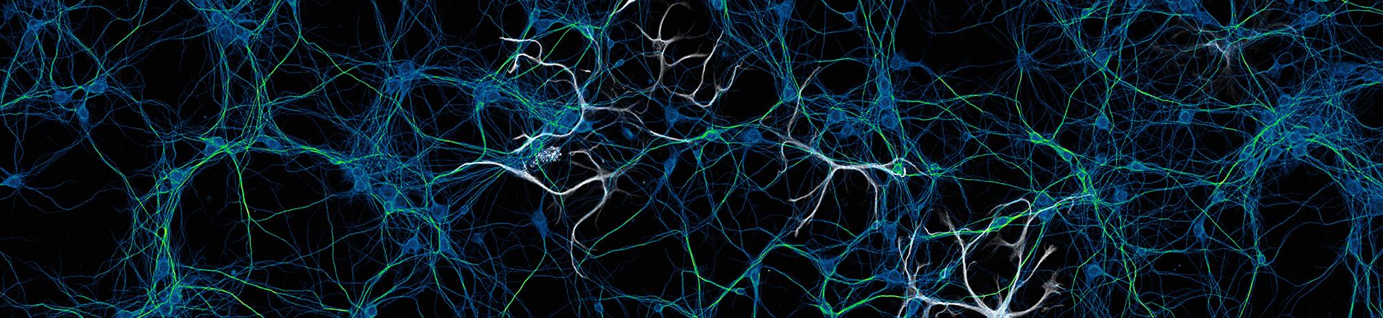 A neural micrograph of blue lines crisscrossing on a dark background 